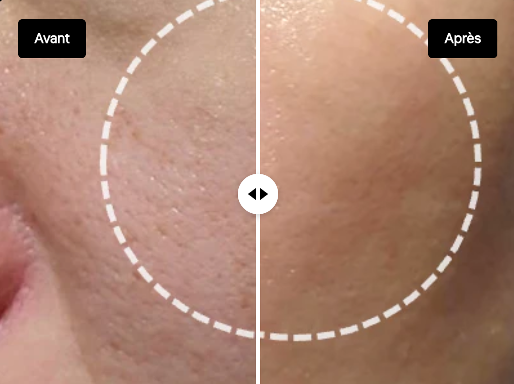 LA NOUVELLE PEAU - T01 Essence Nouvelle Cellule Moussante 150ml