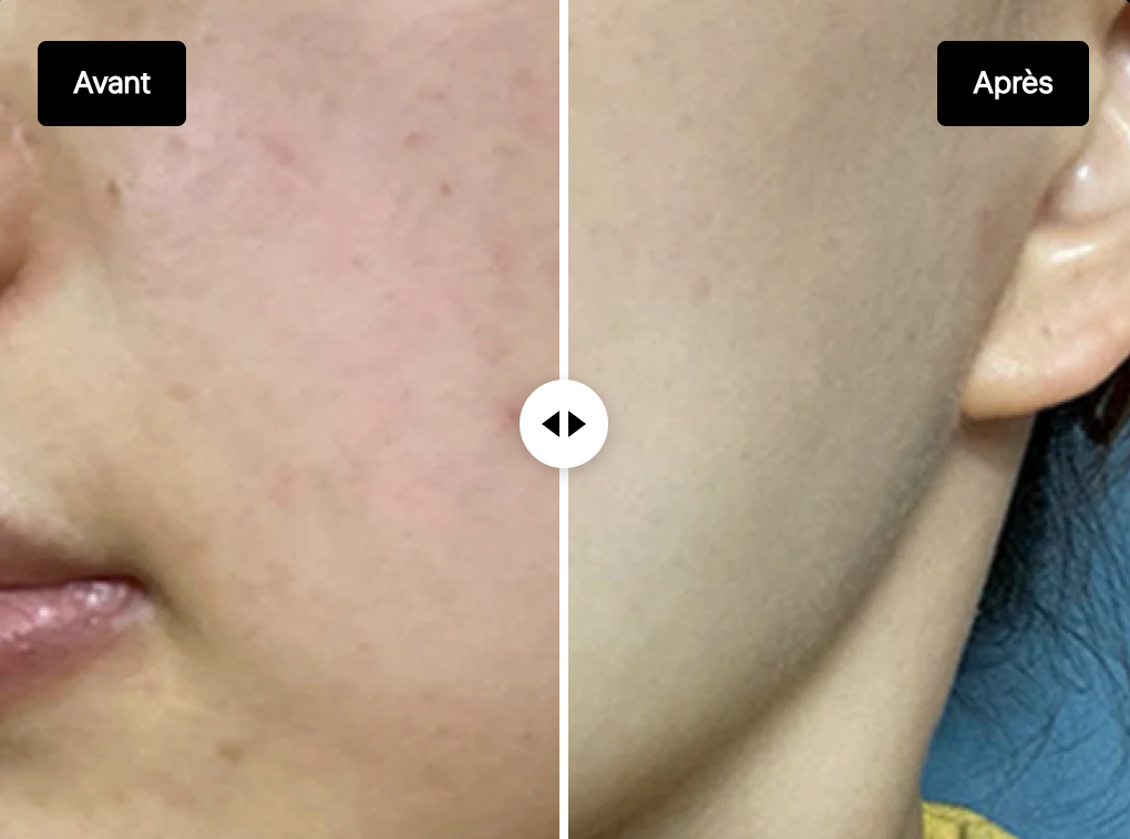 LA NOUVELLE PEAU - R01 Masque Rejuskin (7 masques)