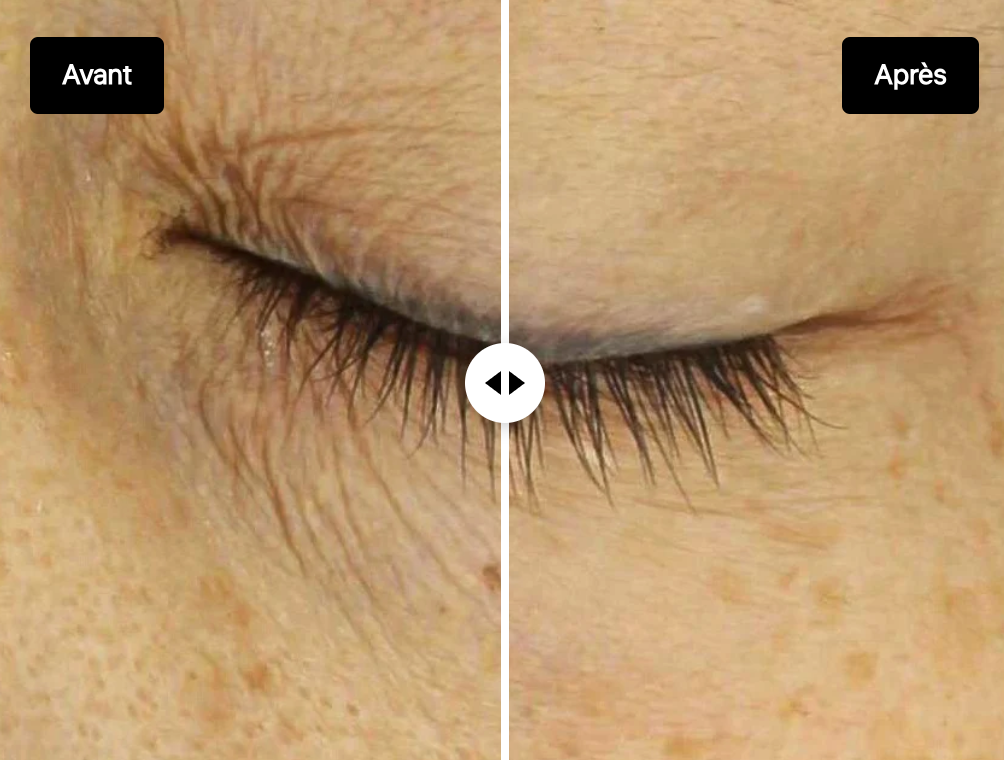 LA NOUVELLE PEAU - T01 Sérum pour les yeux à action totale