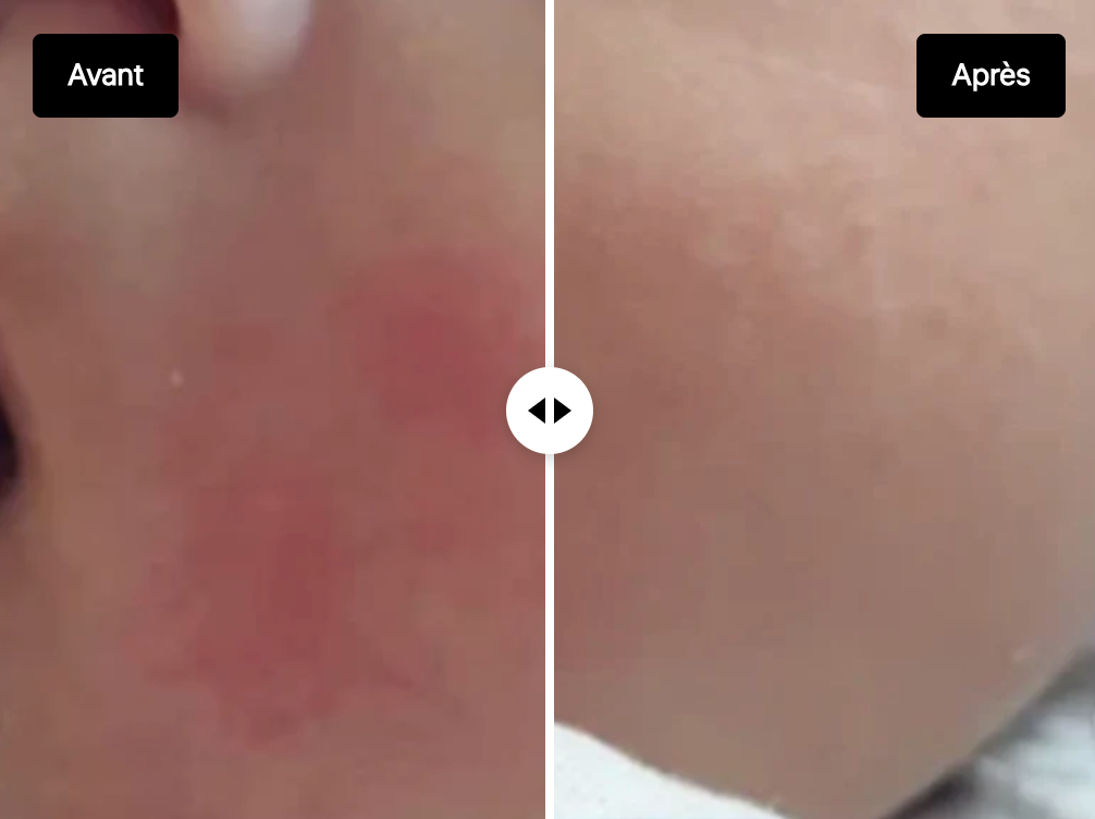 LA NOUVELLE PEAU - Baume Dermo-Réparateur