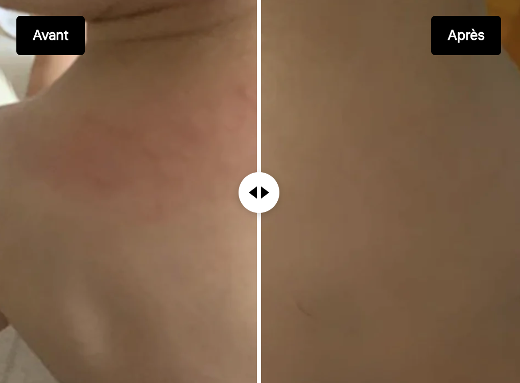 LA NOUVELLE PEAU - Huile Multi Fonctions