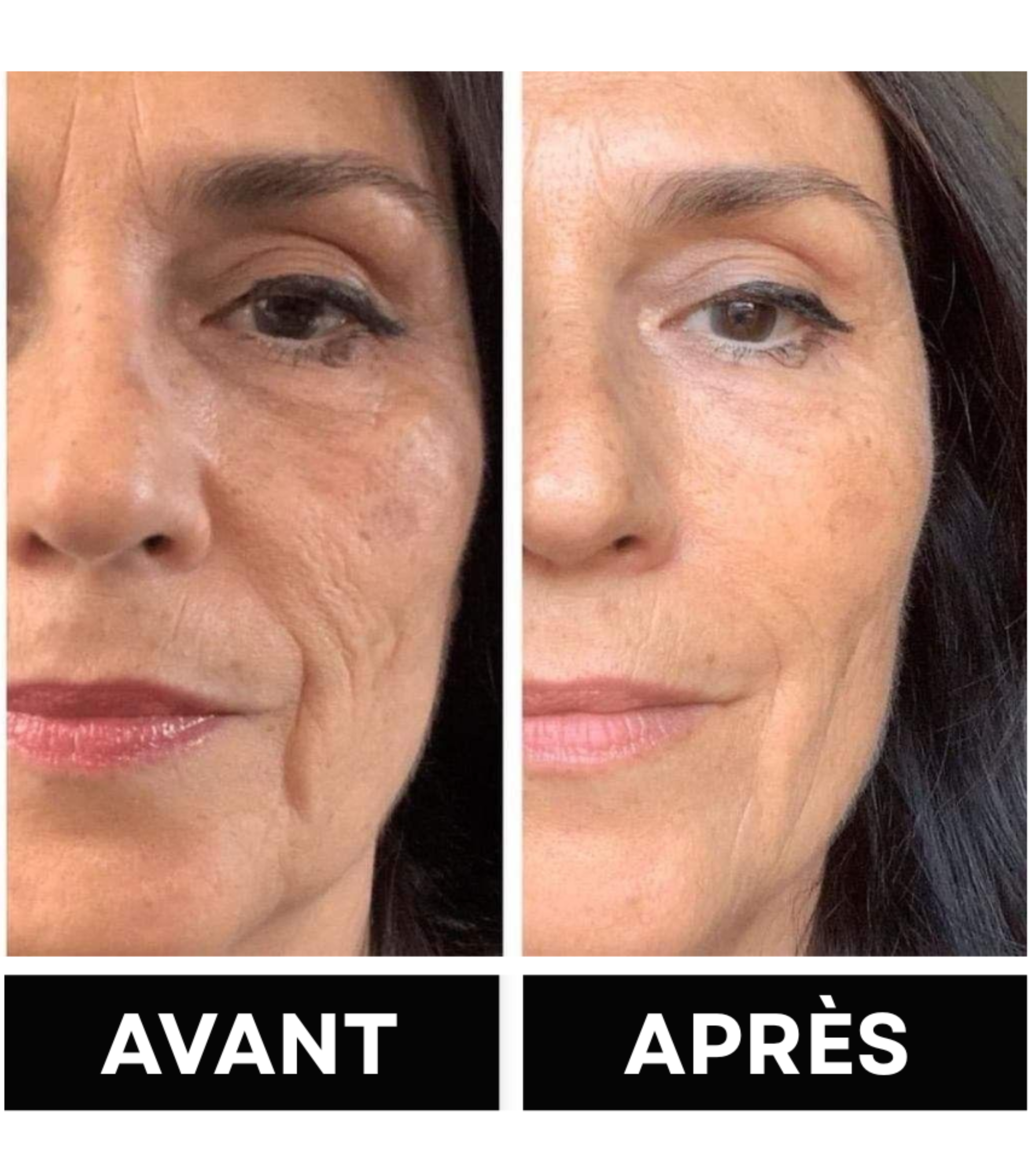 LUMISOO - Masque visage